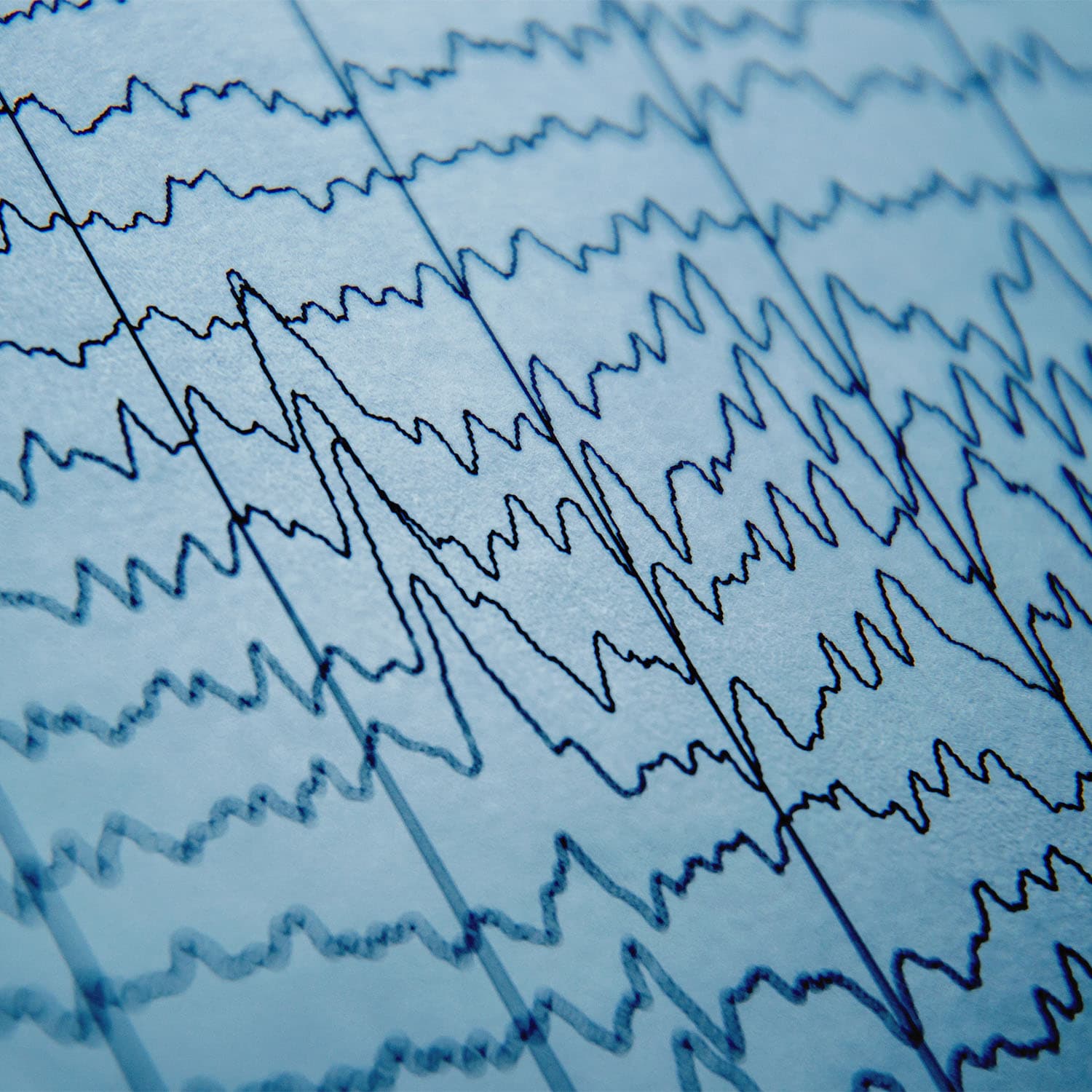 EEG wave in human brain